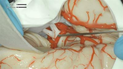 Exoscope and operative microscope for training in microneurosurgery: A laboratory investigation on a model of cranial approach